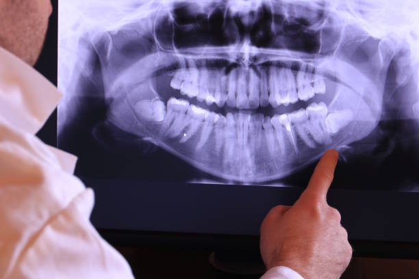 Best Emergency Dental Care for Broken or Chipped Teeth in Milan, IN